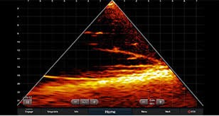 LVS12 LiveScope Down showing trees and fish below boat